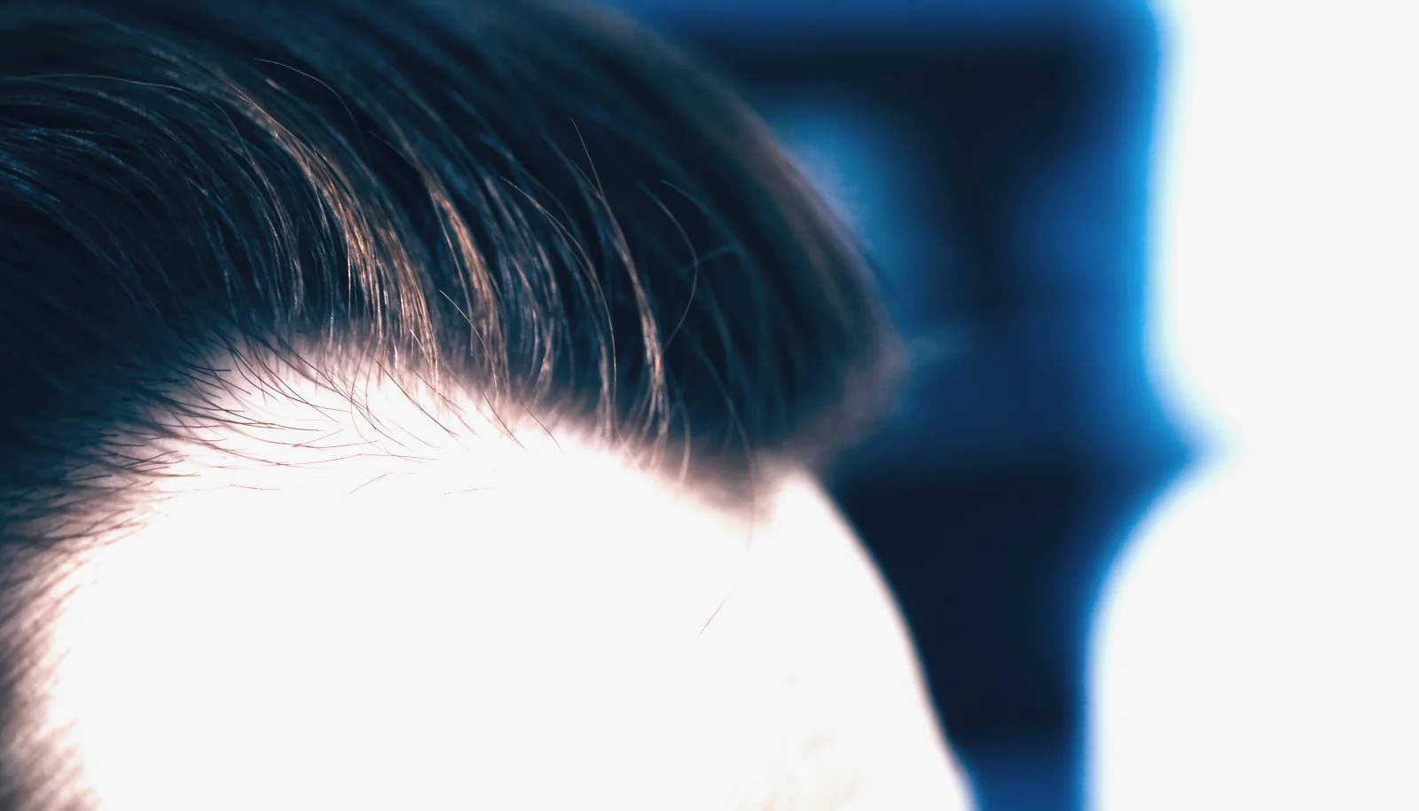 Alopezie 1 Peptide kaufen Nahaufnahme von Scheitel und Haaransatz